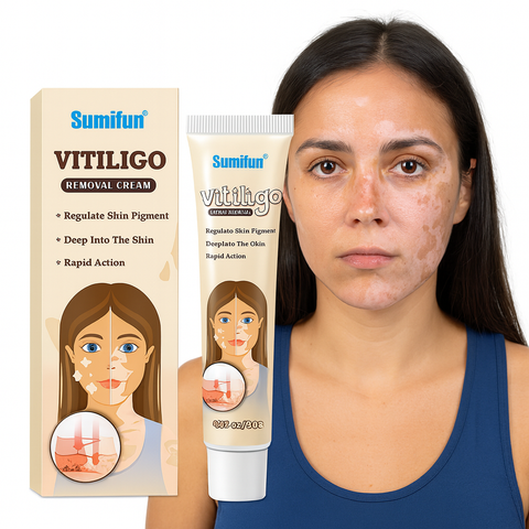 BUY 1 TAKE 3 | Sumifun Vitiligo Treatment Cream - White Spot Care & Antibacterial Herbal Formula