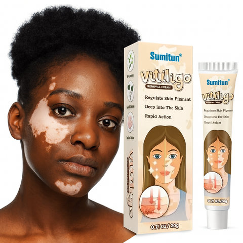 BUY 1 TAKE 3 | Sumifun Vitiligo Treatment Cream - White Spot Care & Antibacterial Herbal Formula