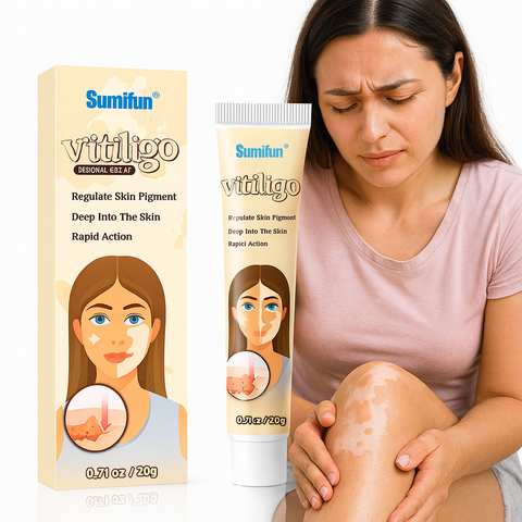 BUY 1 TAKE 3 | Sumifun Vitiligo Treatment Cream - White Spot Care & Antibacterial Herbal Formula