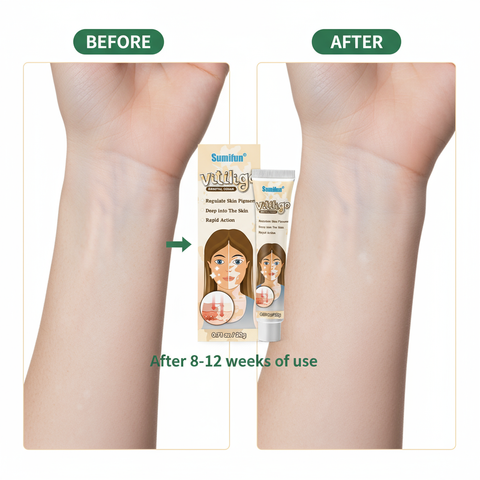 Sumifun使用前后对比图