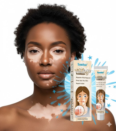 BUY 1 TAKE 3 | Sumifun Vitiligo Treatment Cream - White Spot Care & Antibacterial Herbal Formula