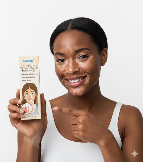 BUY 1 TAKE 3 | Sumifun Vitiligo Treatment Cream - White Spot Care & Antibacterial Herbal Formula