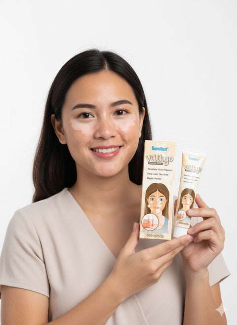 BUY 1 TAKE 3 | Sumifun Vitiligo Removal Cream 20g - Natural White Spot Treatment